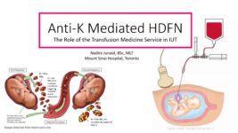 Anti-K Mediated HDFN – The Role of the Transfusion Medicine Service in IUT